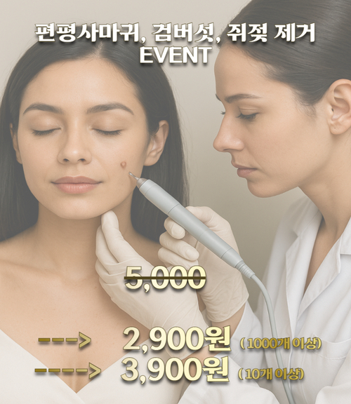 검버섯, 쥐젖.jpg