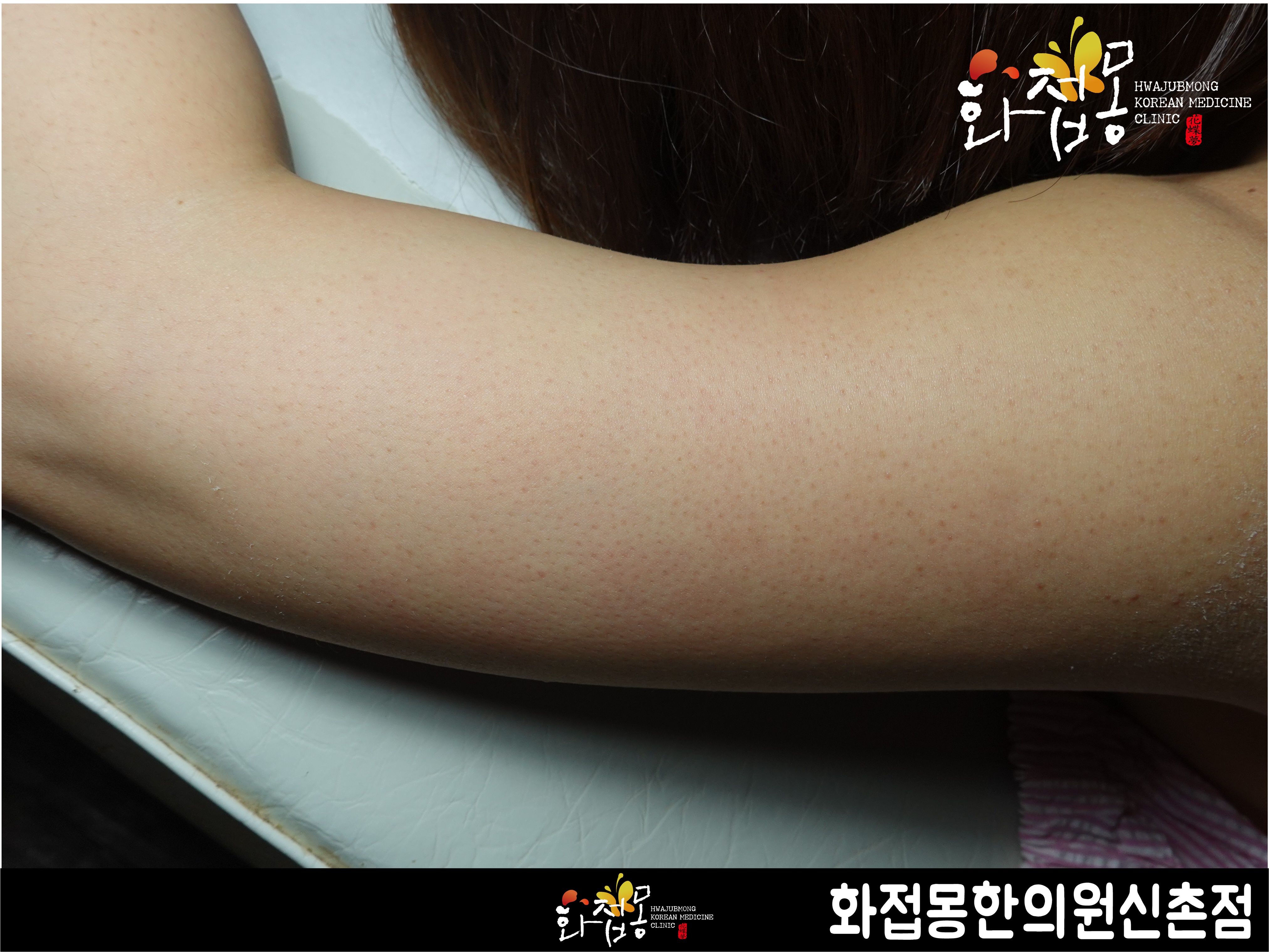 전후사진