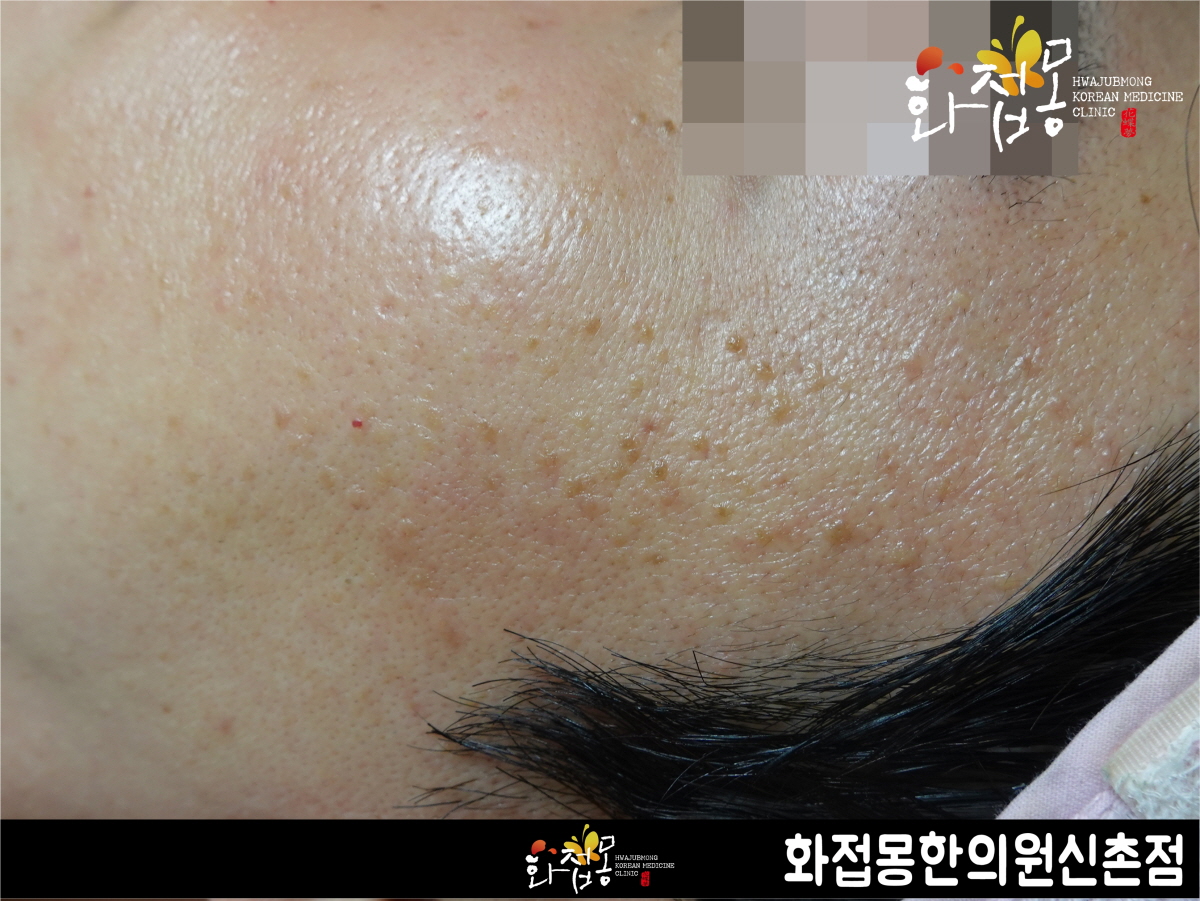 전후사진