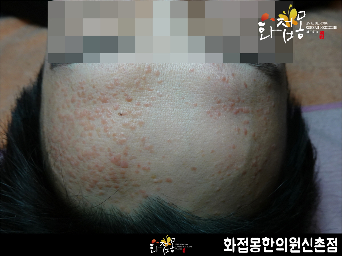 전후사진