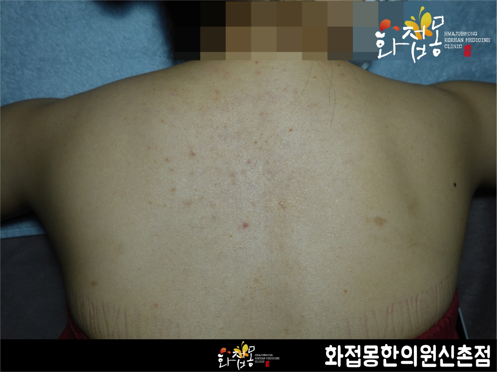 전후사진