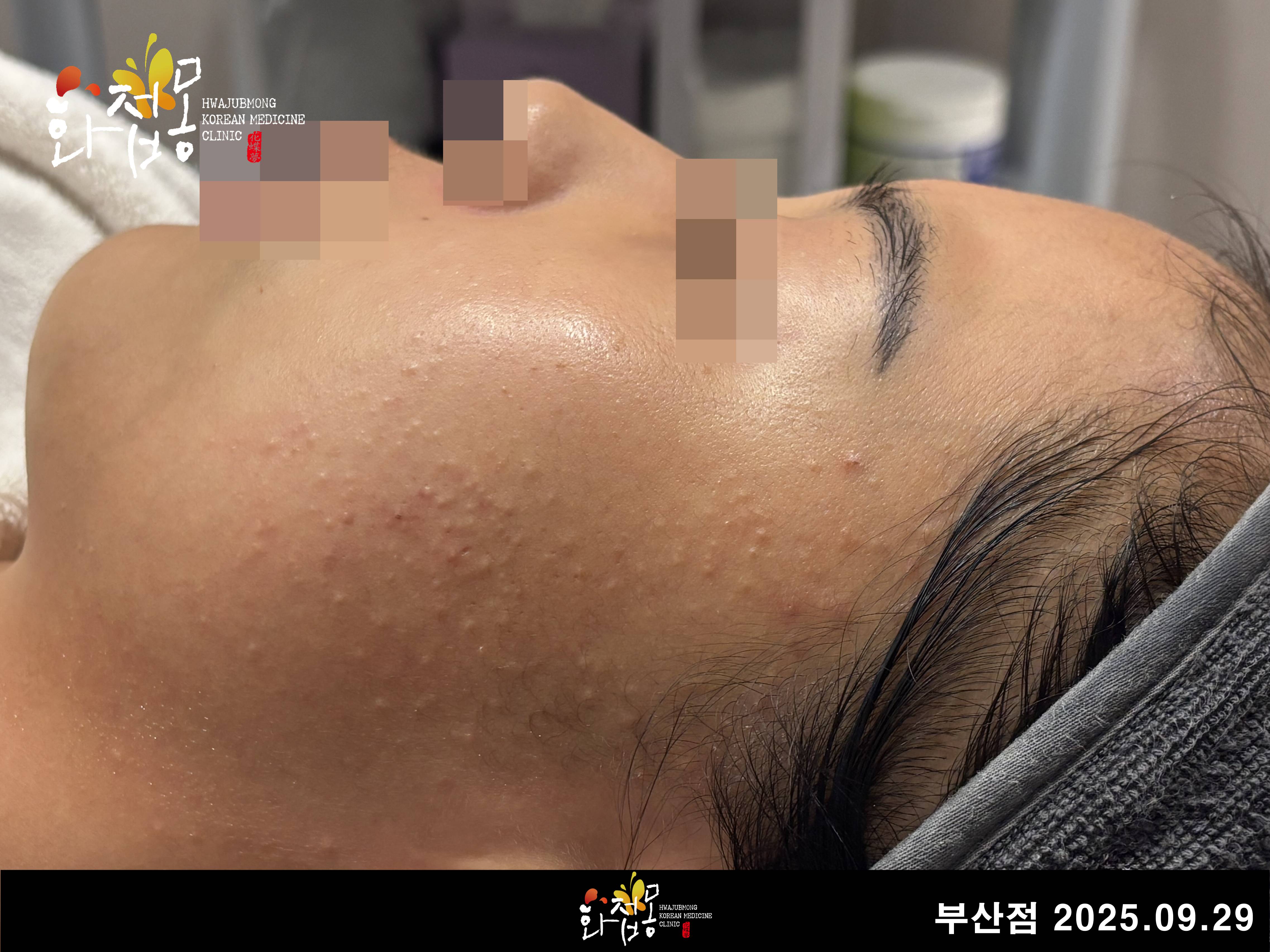 전후사진