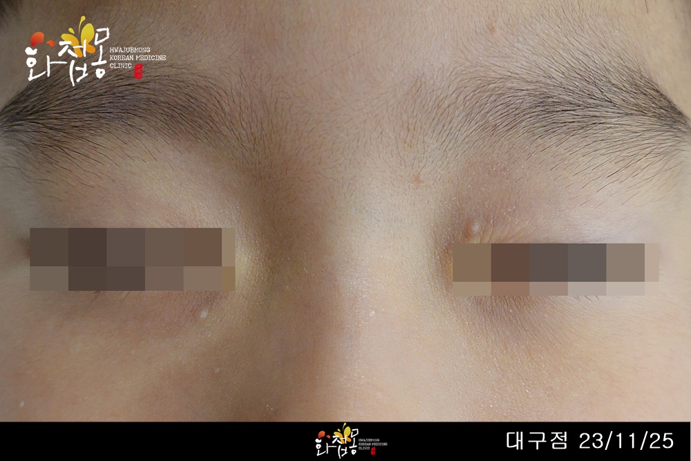 전후사진