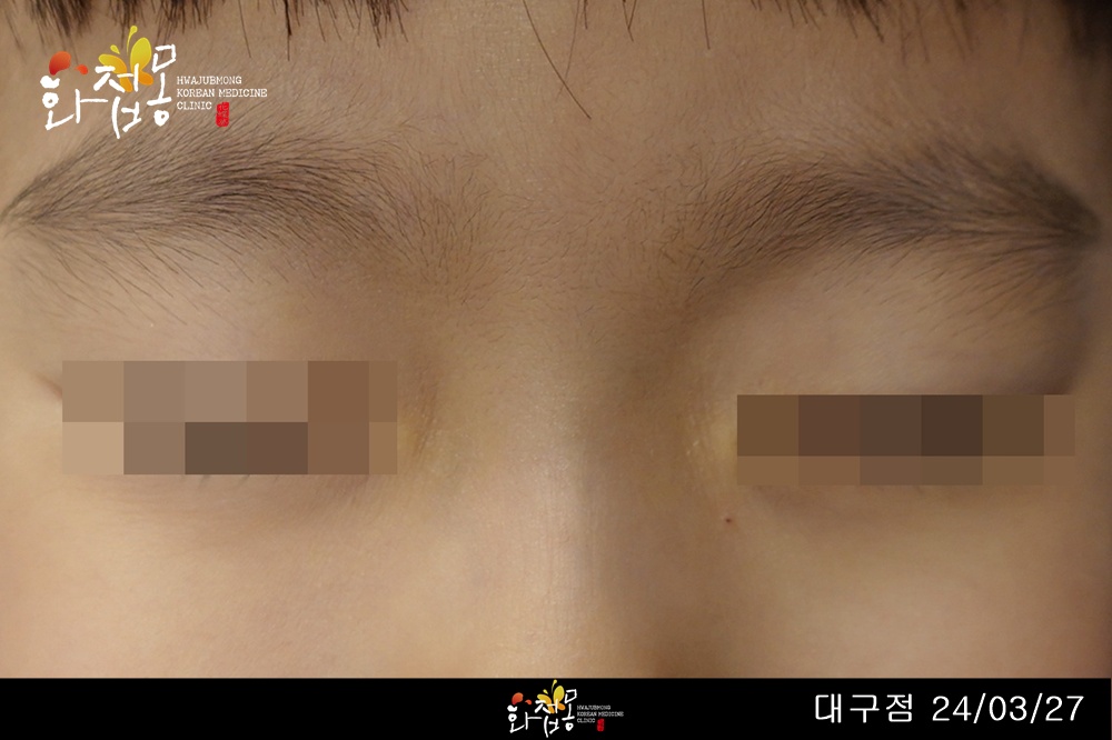 전후사진