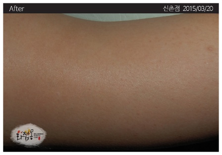전후사진
